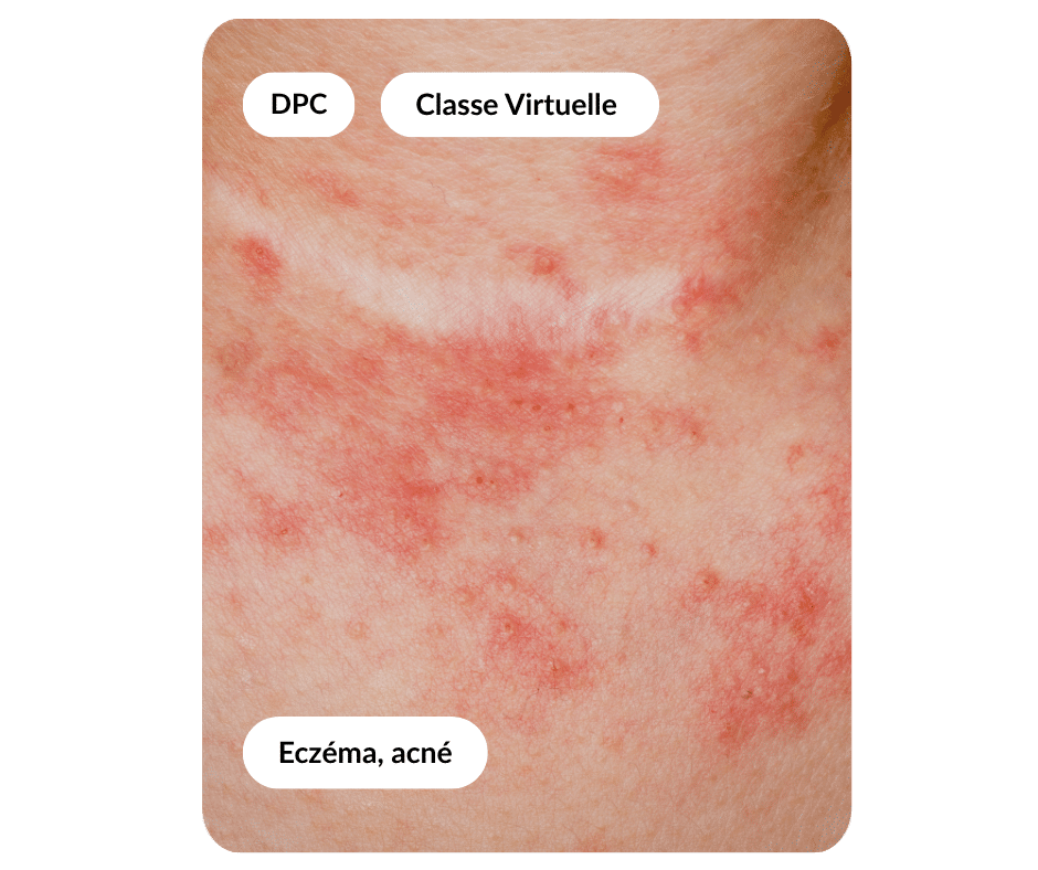 Visuels carte formation RDP